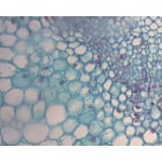 Korzeń młodej_wyki Korzeń młodej wyki