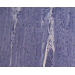 Mięsień szkieletowy Mięsień szkieletowy